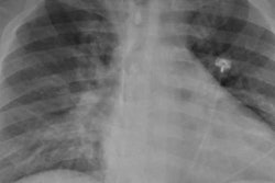2020 11 17 20 14 1672 2020 11 18 Rsna Freeman Image 20201117203919