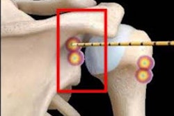 2020 11 18 00 35 8920 2020 11 17 Xray Arthritis