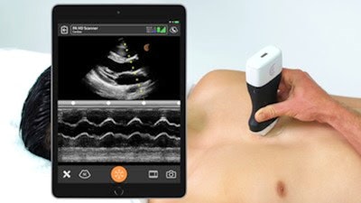 Clarius Mobile Health's PA HD scanner. Image courtesy of Clarius Mobile Health.