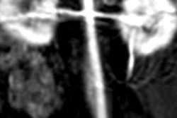 2017 11 17 22 49 0030 Magnesium Mri Contrast Agent 20171117225819