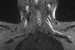 2020 11 25 21 05 4429 2020 12 01 Mri Covid Weakness 20201125213354