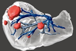 2020 12 01 17 01 8678 2020 12 01 Portugal Intrahepatic Masses 400