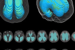 2020 12 02 00 54 0460 2020 12 01 Ai For Mri 400