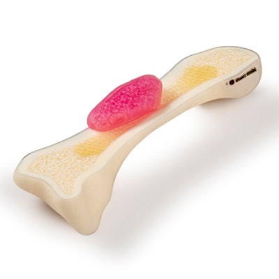 The Stratasys J750 3D printer produces accurate models of patient bones down to the voxel level, including marrow. Image courtesy of Business Wire.