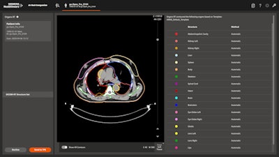 AI-Rad Companion Organs RT is an AI-based application for guiding radiation therapy treatment. Image courtesy of Siemens.