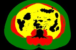 2020 12 02 19 52 9567 2020 12 02 Ai Body Composition 400