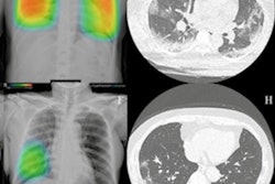 2020 12 07 23 03 0948 2020 12 7 Lunit Covid 19 400