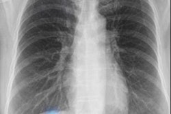 2020 12 11 17 56 0055 2020 12 11 Ai Lung Cancer A C 20201211175644