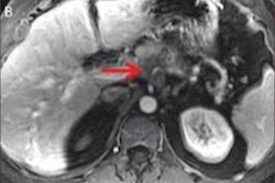 2020 12 12 00 42 8918 2020 12 09 Ajr Pet Mri Ct 400