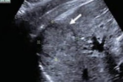 2020 12 14 20 50 5249 2020 12 15 Radiology Tare Image 20201214204233