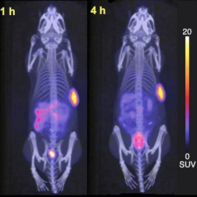 Representative maximum-intensity projection PET/CT images of AR42J tumor-bearing female Balb/c nude mice following injection of Cu-64 CuSarTATE (3 MBq, 0.24 nmol of peptide) at one and four hours after injection. Images created by associate professor Carleen Cullinane of Peter MacCallum Cancer Centre.
