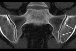 2020 12 23 00 19 2070 2020 12 23 Radiology Editorial Fritz Image 400