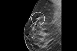 2020 12 24 00 44 7359 2020 12 24 Radiology Dbt