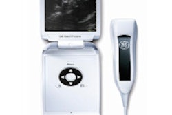 2014 02 21 17 24 32 839 Ge V Scan Compact Ultrasound 200