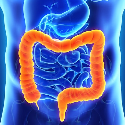 2017 11 15 21 16 4926 Colon Intestine 400