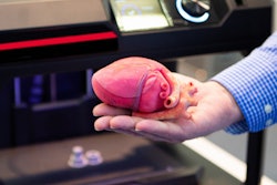 2020 03 15 23 17 9572 3 D Printed Heart2 400