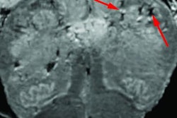 2021 01 04 19 01 0241 2021 01 Nih Brain Covid Study 20210104192421