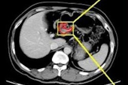2021 01 07 18 07 3001 2021 01 07 Ai Gastric 20210107181315