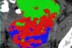 2021 01 07 20 51 7755 2020 01 07 Virtual Biopsy 20210107205708