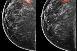 2021 01 08 23 41 3524 2021 01 11 Ai Mammo 20210108234655