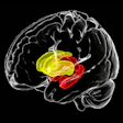 2021 01 15 22 13 4382 2021 01 19 Hiv Brain Volume 400