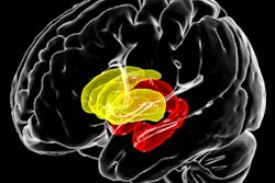 2021 01 15 22 13 4382 2021 01 19 Hiv Brain Volume 400