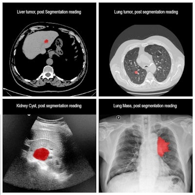 RSIP's AI-based tool can provide multimodality image segmentation and measurements. Images courtesy of RSIP Vision.
