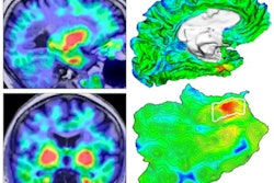 2021 01 21 00 10 7012 2021 01 20 Tau Alzheimers 400