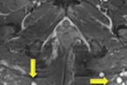 2021 01 21 16 58 8449 2021 01 22 Case2 Buttocks 20210115203500