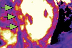 2021 01 22 18 05 7072 2021 01 22 3 D Cardiac Mri Image2