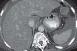 2021 01 23 00 12 1236 2021 01 22 Ajr Nafld 20210123003734