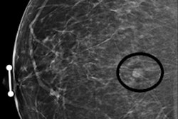 2021 01 23 00 12 6428 2021 01 22 Radiology Imaging Cancer Mammogram2