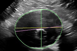 2021 01 27 17 11 4430 2021 01 27 Philips Epiq Aaa Evar Results 20210127175213