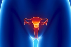2019 12 20 22 10 2888 Uterus Cervix 400