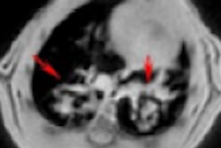 2021 01 28 21 23 8159 2021 02 01 Bruker 400