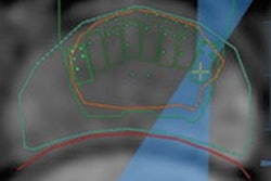 2021 02 03 21 18 2444 2021 02 04 M Rg Fus Prostate 20210203212322