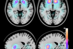 2021 02 05 21 35 2797 2021 02 08 Spect Brain Image2