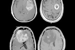 2021 02 10 23 22 4079 2021 02 11 Cancer Cell Mri 400