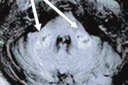 2021 02 19 00 05 8365 2021 02 19 Ajr Mri Covid