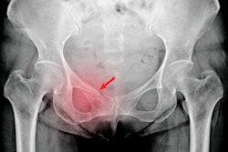2021 02 19 23 22 0028 X Ray Pelvis Hip 400