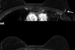 2021 02 24 00 14 3369 2021 02 24 Breast Cancer Abbrev Mri Figure3 20210224002521
