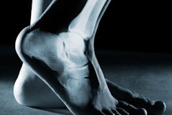 2019 02 25 22 45 7072 Foot Ankle 400