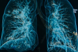 2019 04 25 20 01 3039 Lung 3 D 400