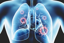 2020 04 15 20 00 7340 Coronavirus Cells Lungs 400