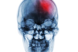 2021 02 23 18 36 5807 Stroke Skull Xray 400