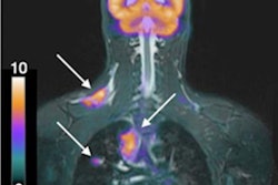 2021 03 01 05 21 3363 2021 03 03 Fdg Pet Mri Hodgkins Pedx Jnm 20210301054746