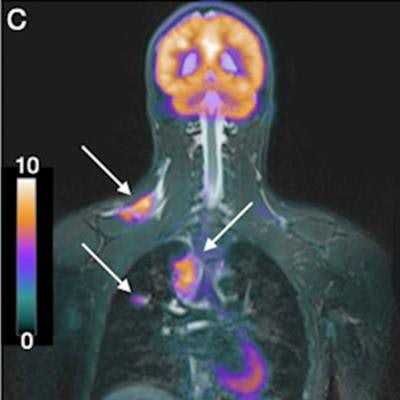 The diagnostic accuracy and clinical impact of FDG-PET/CT follow