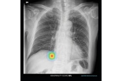 2021 03 04 21 11 9922 2021 03 04 Lunit 400