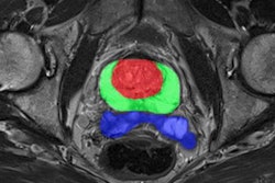 2021 03 05 17 10 1148 2021 03 04 Quibim 20210305174849