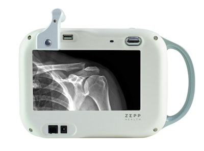 The Europa portable x-ray system by Zepp Health and Rouumtech. Image courtesy of Zepp Health.